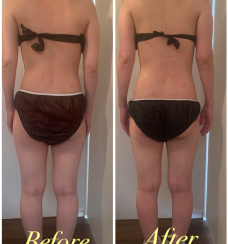 妊娠中や産後の骨盤ベルトは必要 骨盤ベルトのデメリットを解説 大阪市福島区マタニティサロンann B